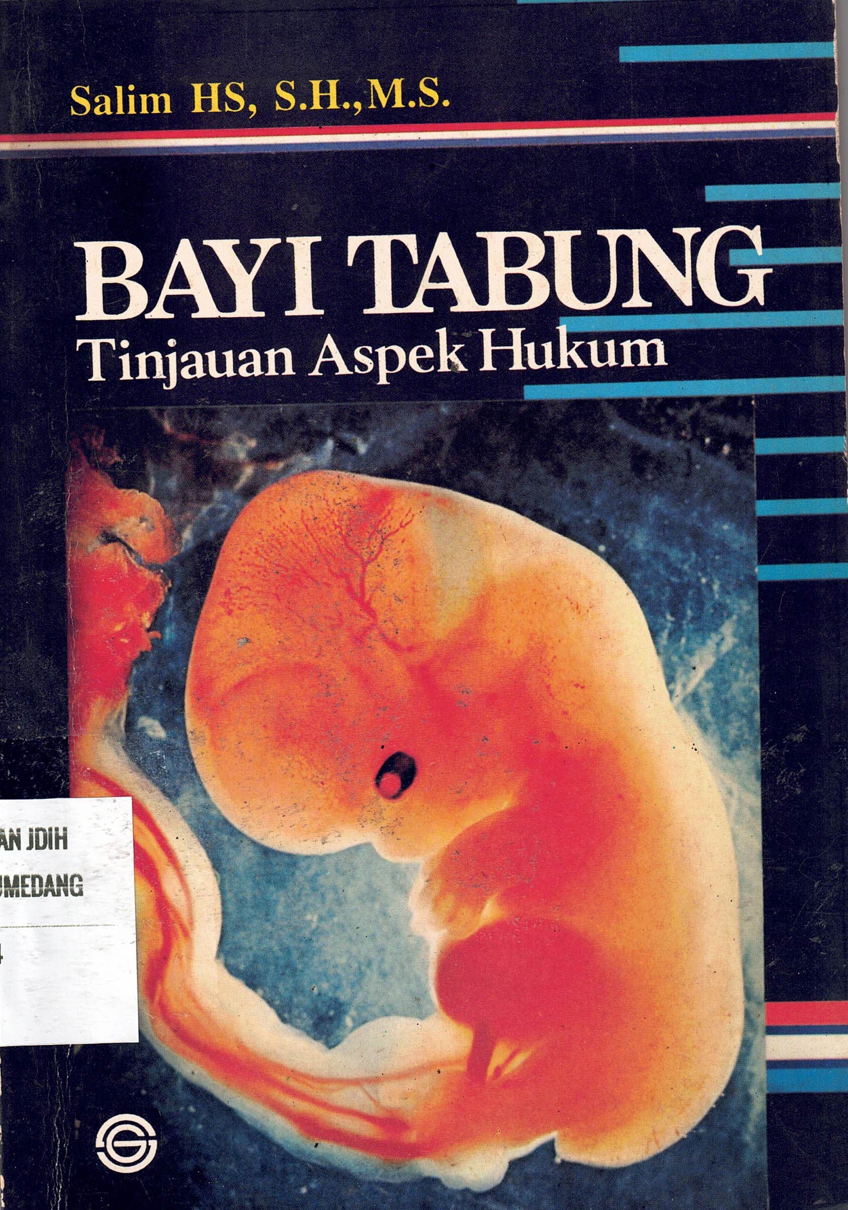 Bayi Tabung Tinjauan Aspek Hukum